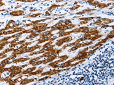 AIFM1 Antibody