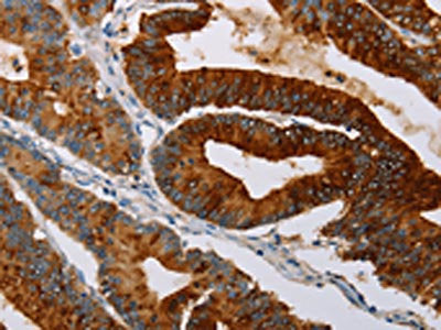 TFF3 Antibody