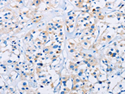 CD33 Antibody