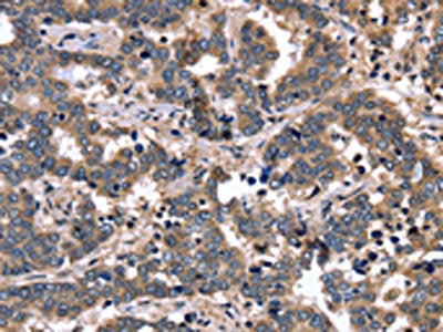 FGFR1OP2 Antibody