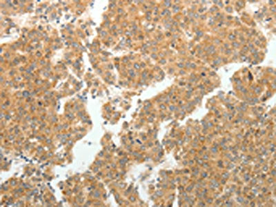 GEMIN2 Antibody