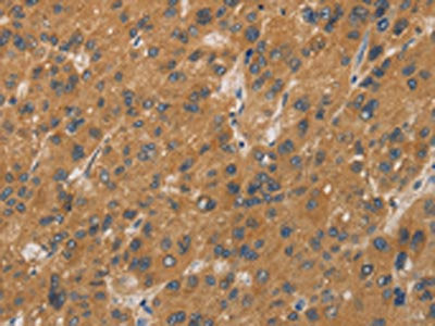CYP17A1 Antibody