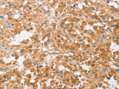 CDKN2C Antibody