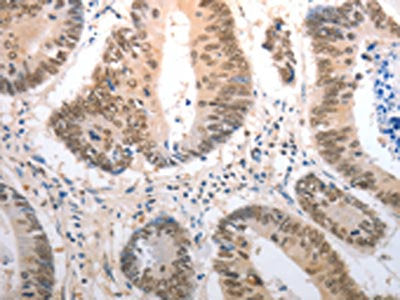 RAD50 Antibody