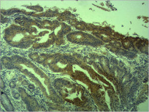BIRC5 Antibody