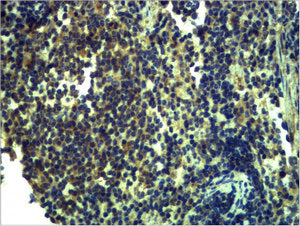 TLR13 Antibody