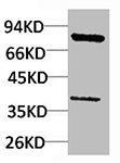 PIK3R1 Antibody