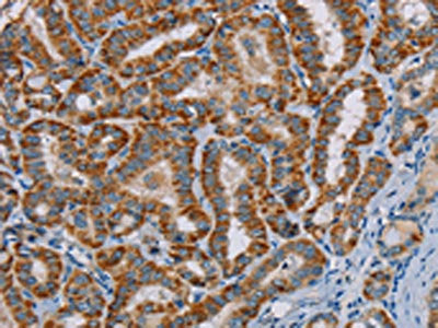 MTCH2 Antibody