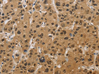 HSPA4 Antibody
