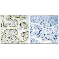MRPL42 Antibody