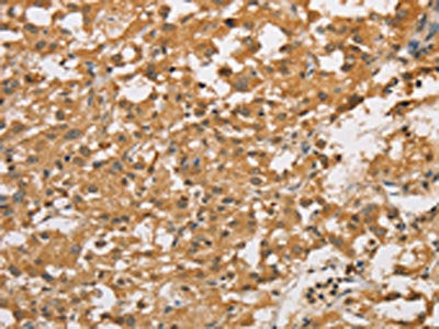 ARHGEF5 Antibody