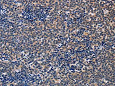 ALG12 Antibody