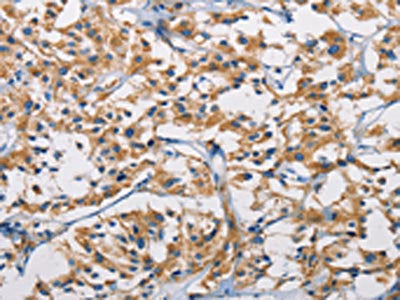 HK1 Antibody