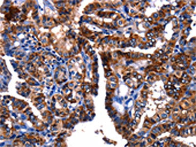 GIP Antibody