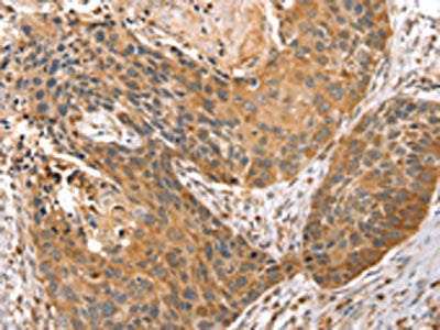 STX10 Antibody