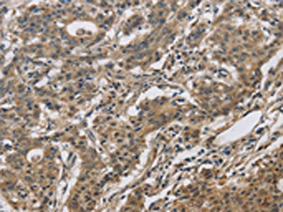 DHRS3 Antibody