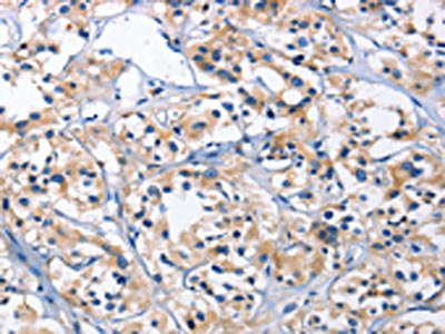 CAPZA2 Antibody