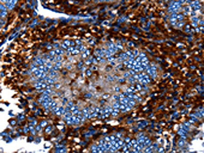 CNGA2 Antibody