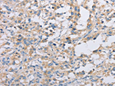 ACTR2 Antibody