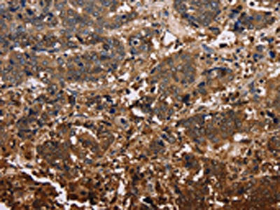 FBP2 Antibody