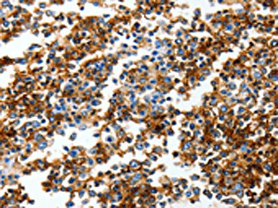 GRIA3 Antibody