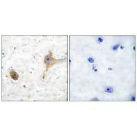 GABBR1 Antibody