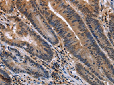 ETV7 Antibody