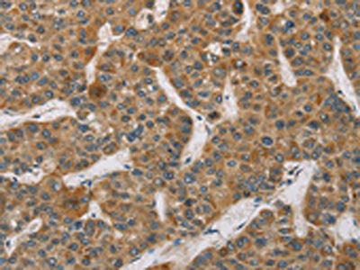 DCTN2 Antibody