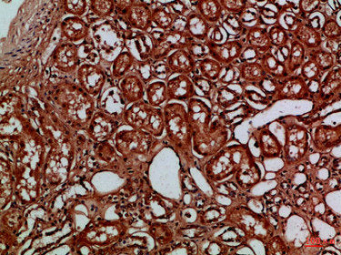 EYA1/EYA4 Antibody