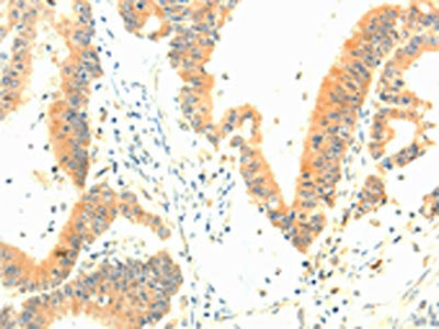 TERF1 Antibody