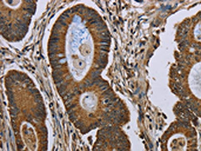 NEFH Antibody