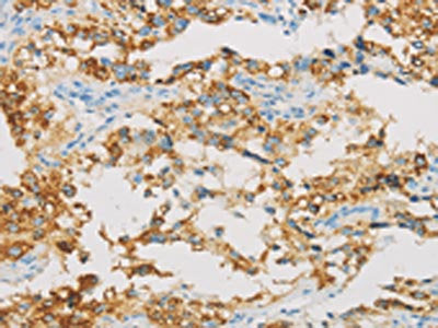 IDH3B Antibody