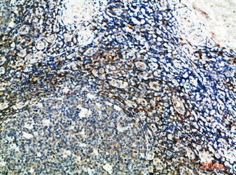 GSC Antibody