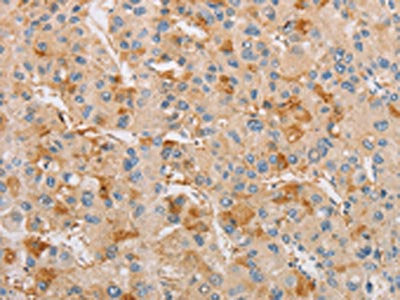 ARSF Antibody