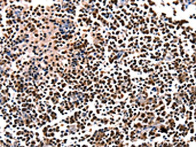 HDAC1 Antibody