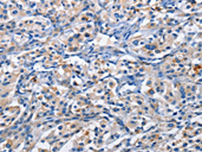 PIM1 Antibody