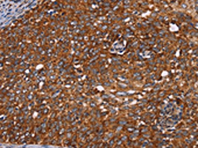 CYP2W1 Antibody