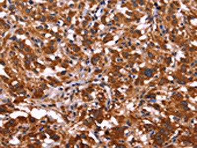 ARL4A Antibody