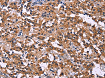 PIP5K1B Antibody