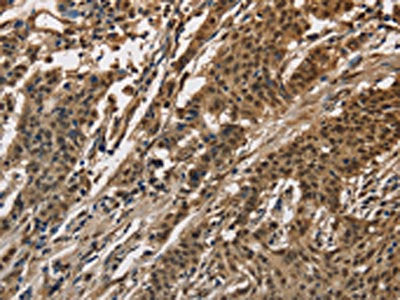 CCAR1 Antibody