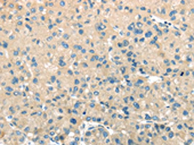 TMPRSS11A Antibody