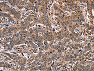 FAAH2 Antibody