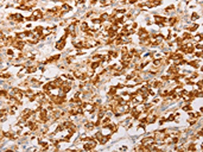AK2 Antibody