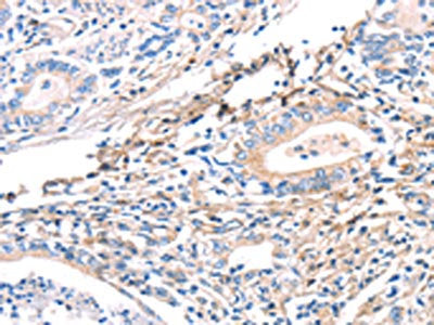 TWF2 Antibody