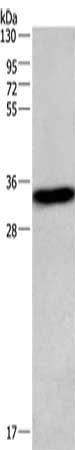 CENPP Antibody