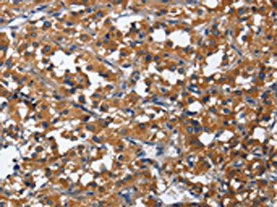 CD27 Antibody