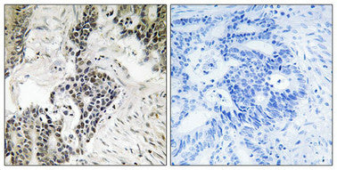 Phospho-CDC25C (Ser198) Antibody