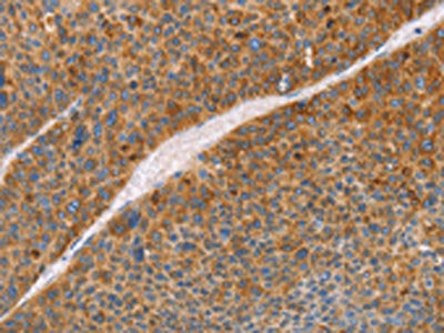 FGL1 Antibody