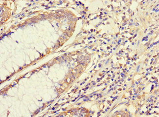 ATG5 Antibody