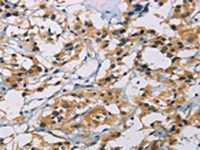 CSNK1E Antibody